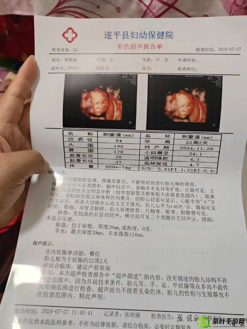 做彩超时医生为何总问有无做四维相关情况